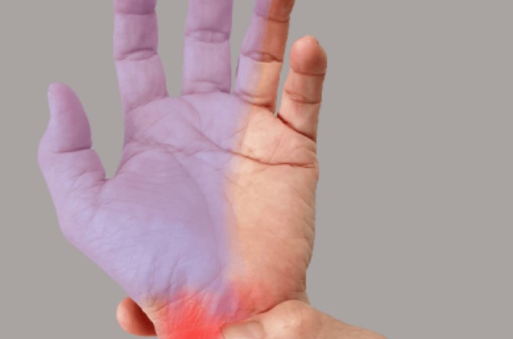 Understanding Carpal Tunnel Syndrome: symptoms, causes and treatment